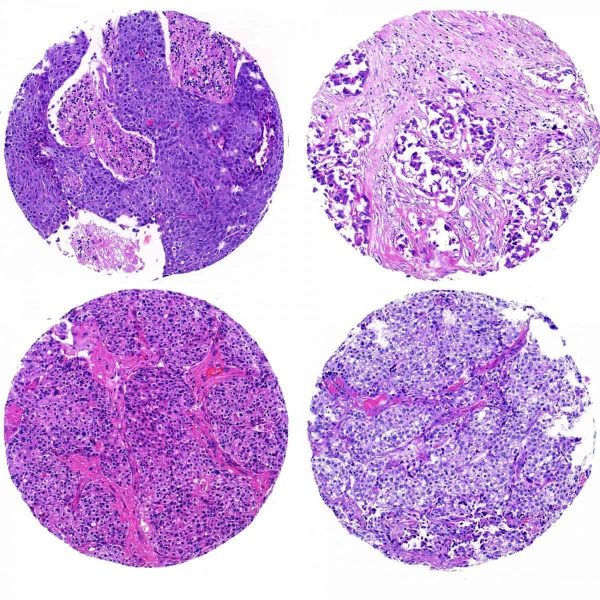 Mopec Histology & IHC Control Slides for TMA and Normal Human Tissue - Image 3